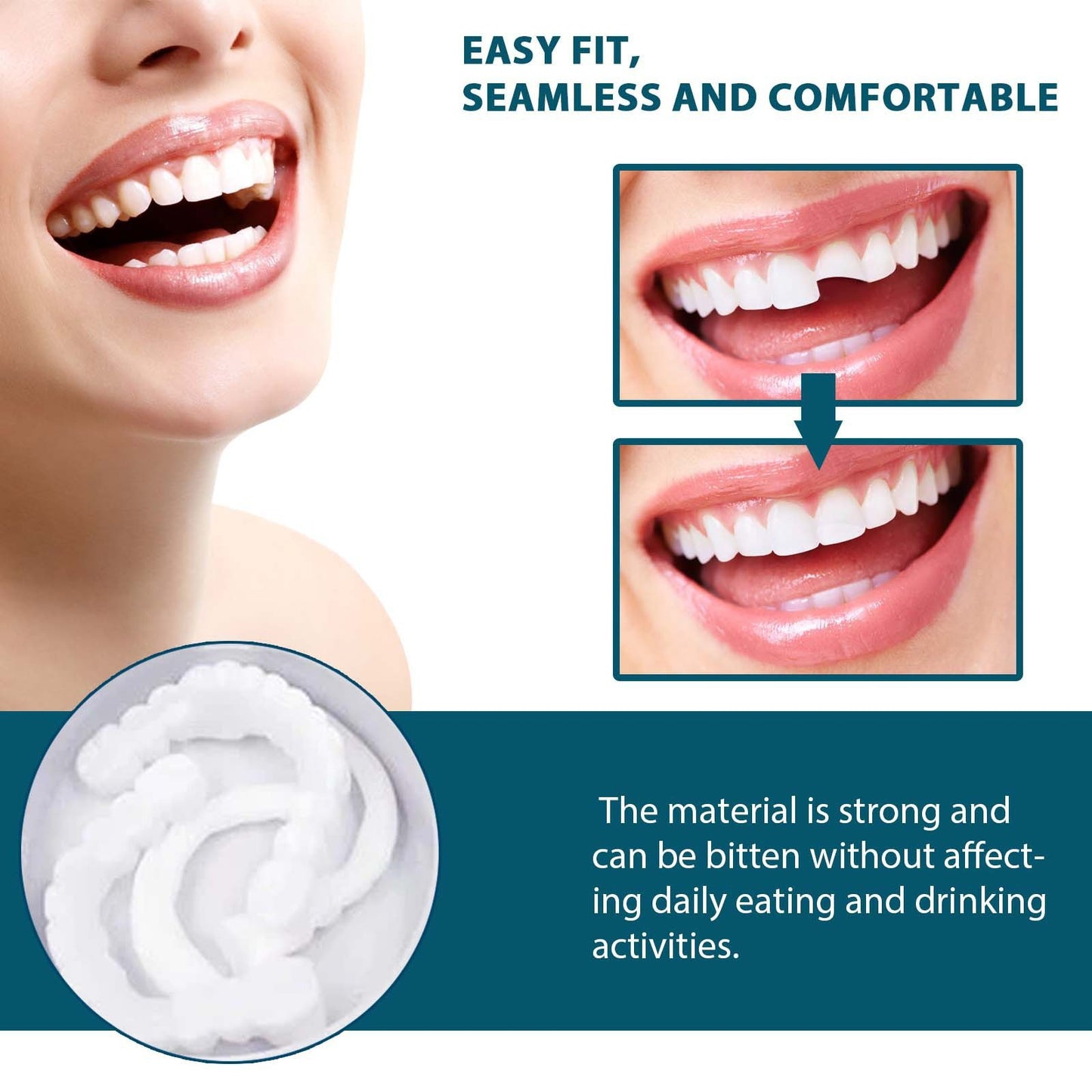 Adjustable Snap On Denture Temporary Filling Braces