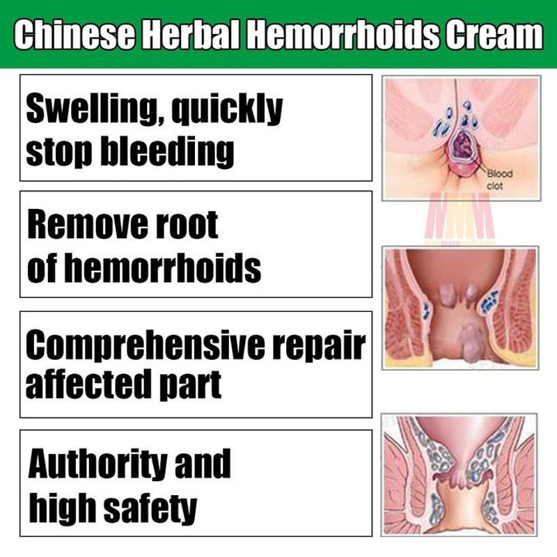 Acne Medicine Hemorrhoids Cream