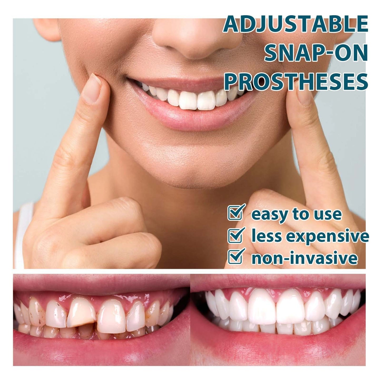 Adjustable Snap On Denture Temporary Filling Braces