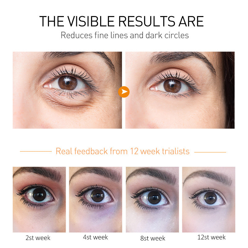 Moisturizing And Firming Eye Cream To Weaken Fine Lines And Dark Circles