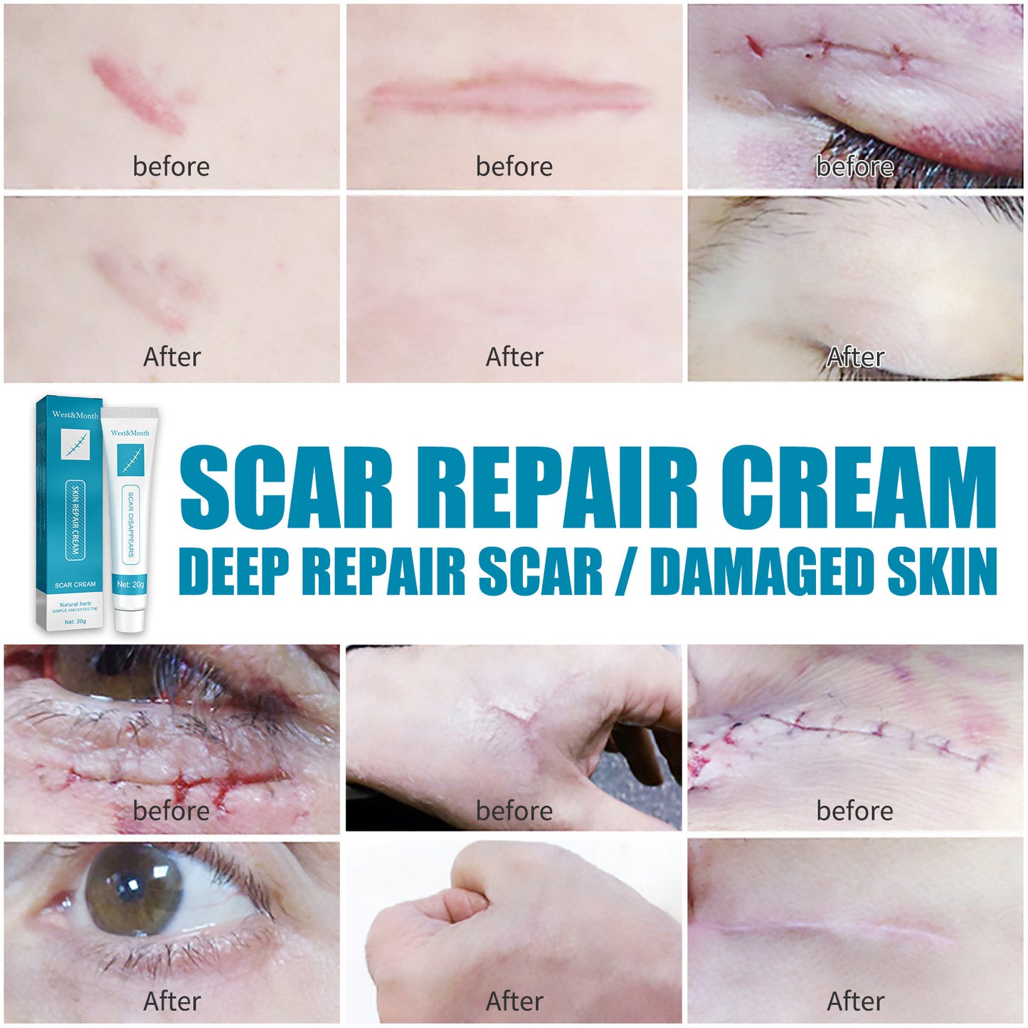 Smooth Skin Scar Repair Cream