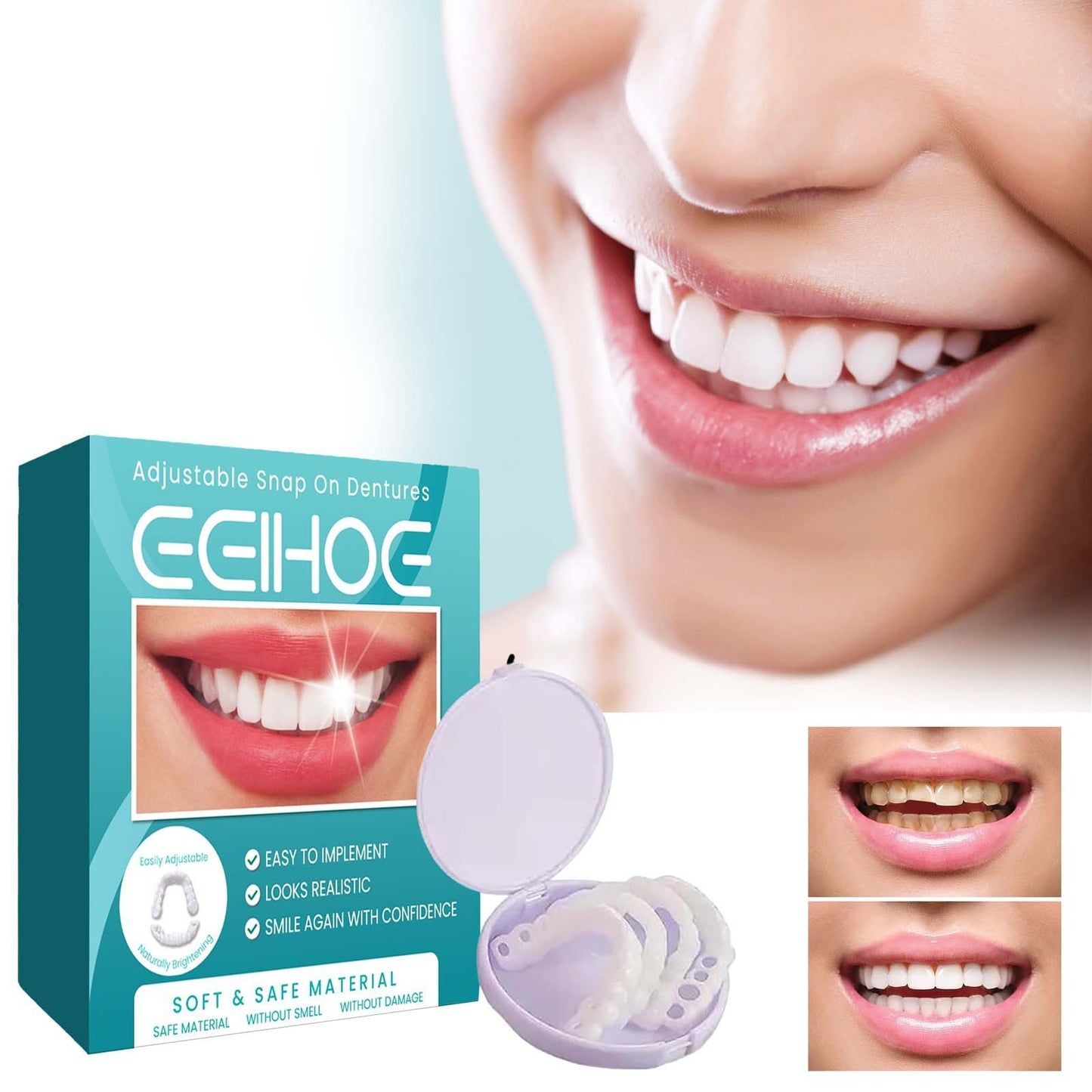 Adjustable Snap On Denture Temporary Filling Braces