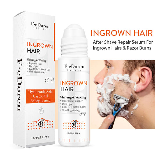 Conveniently Apply Roller Hair In-growth For Men