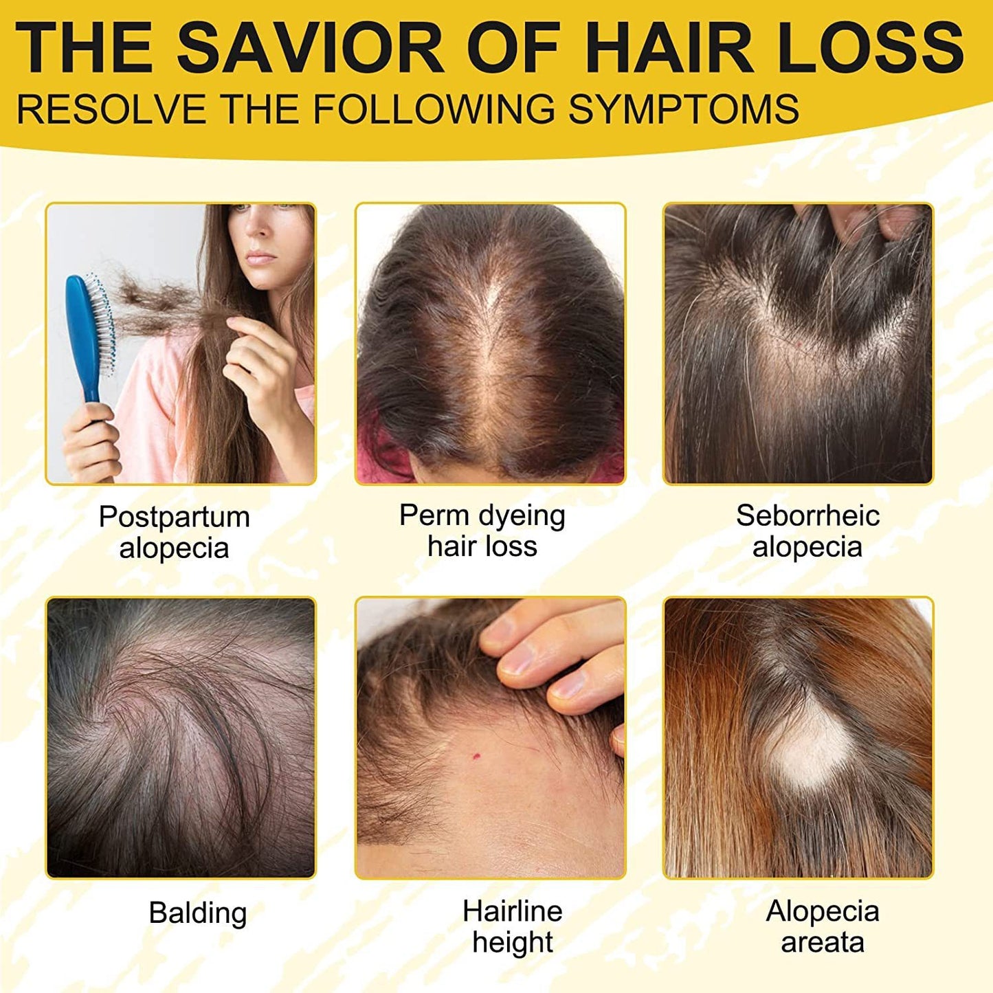 Rice Water Sheng Jiang Wang Hair Nutrient Solution Anti-shedding