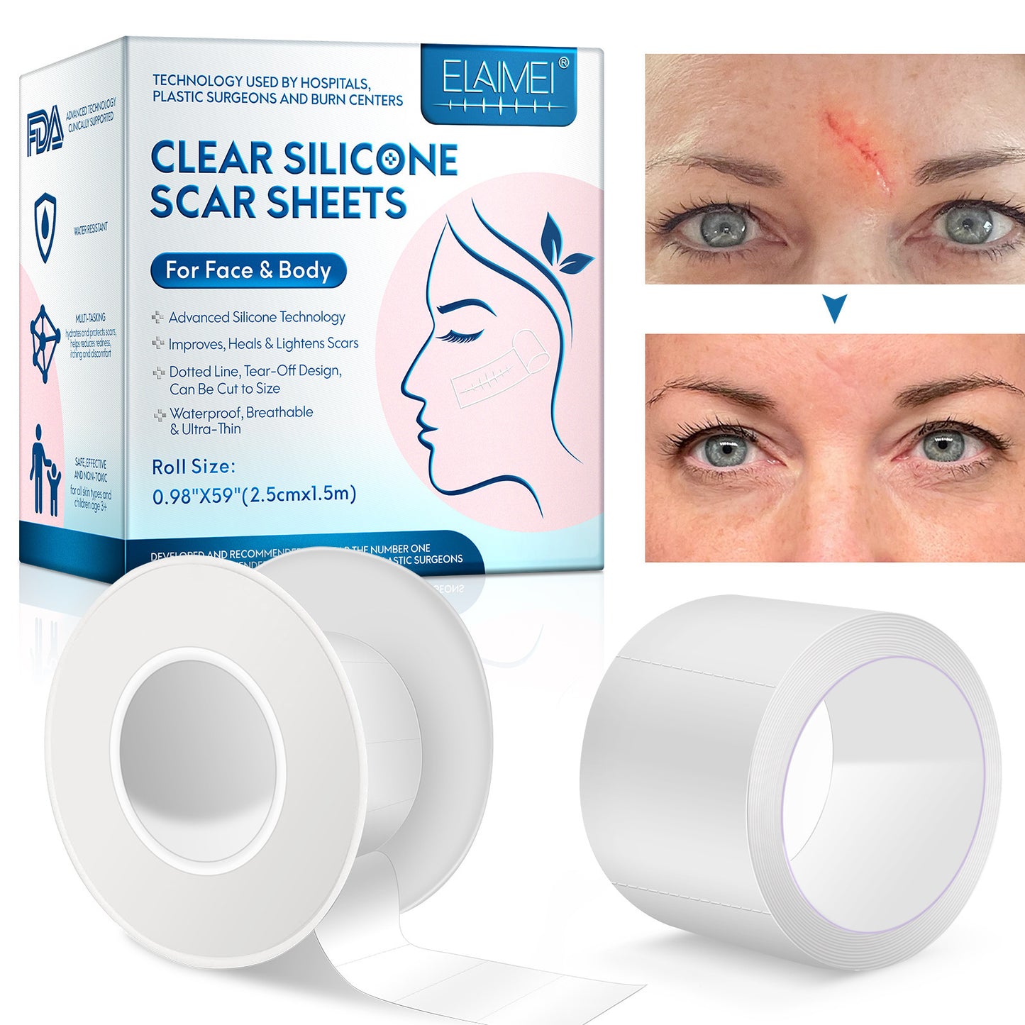 ELAIMEI Facial Invisible Scar Sticker Roll Self-adhesive Waterproof Breathable