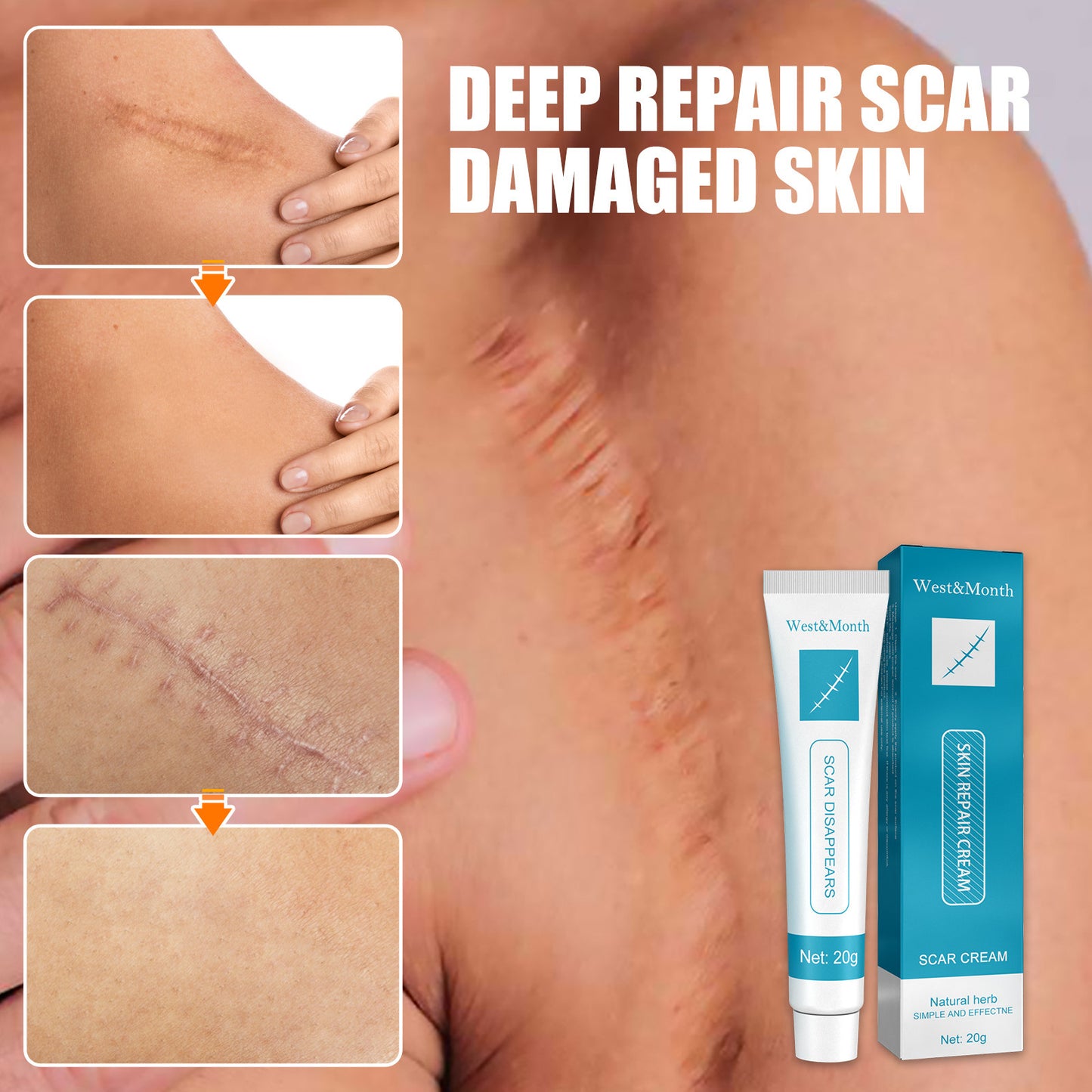 Smooth Skin Scar Repair Cream