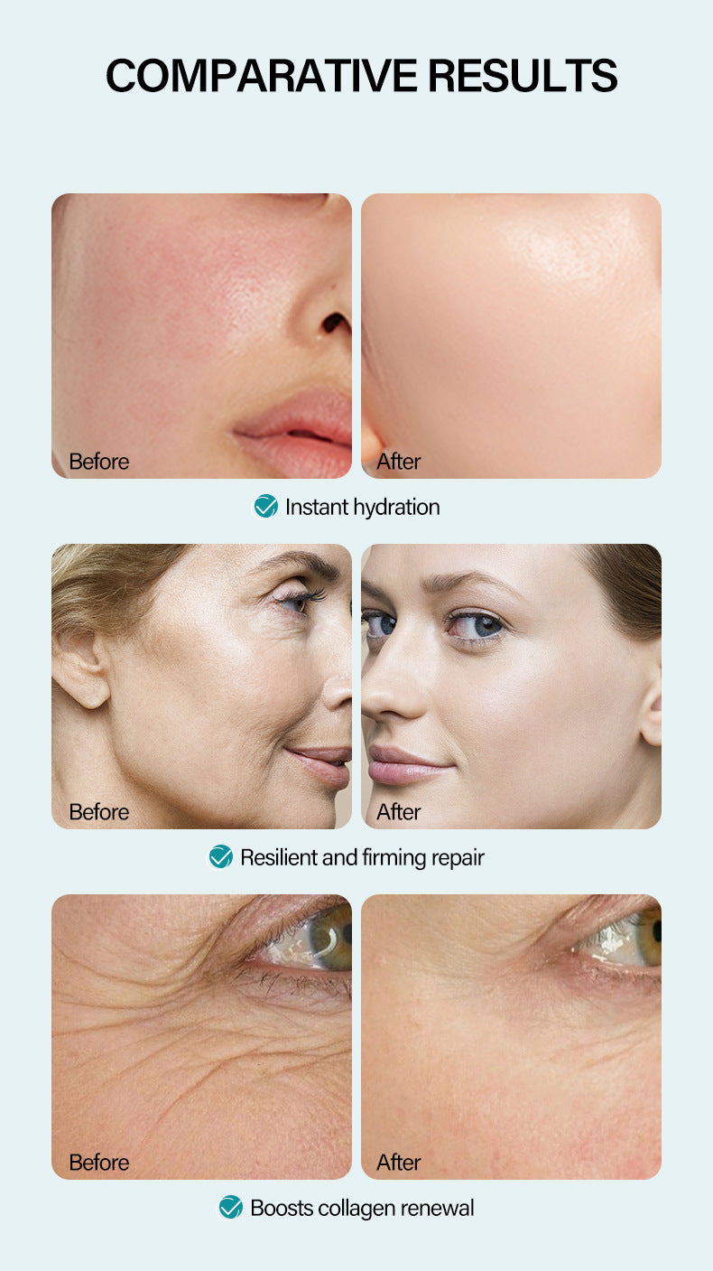 Anti-Wrinkle Face Cream Containing Hyaluronic Acid Hydrating High Moisturizing Fade French