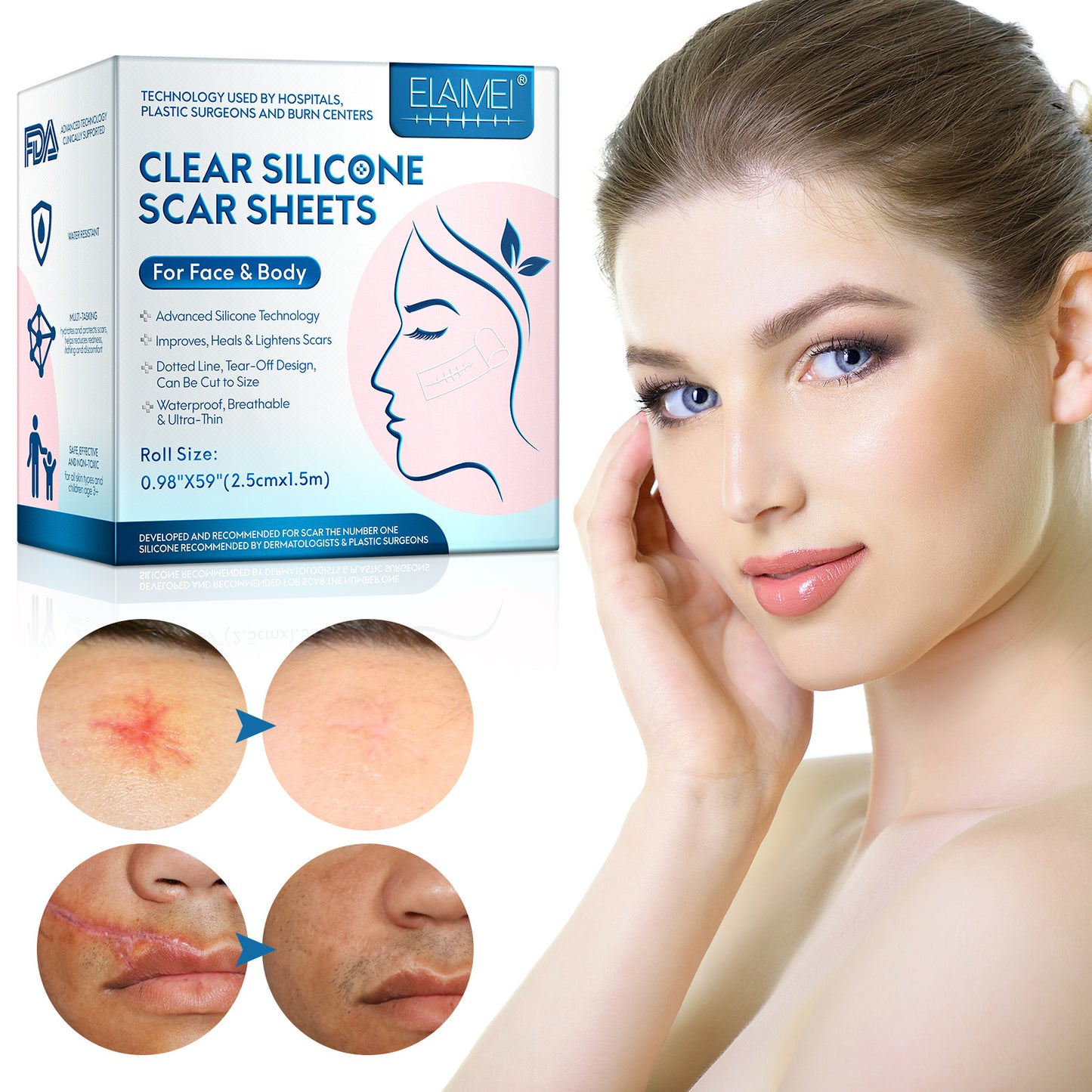 ELAIMEI Facial Invisible Scar Sticker Roll Self-adhesive Waterproof Breathable