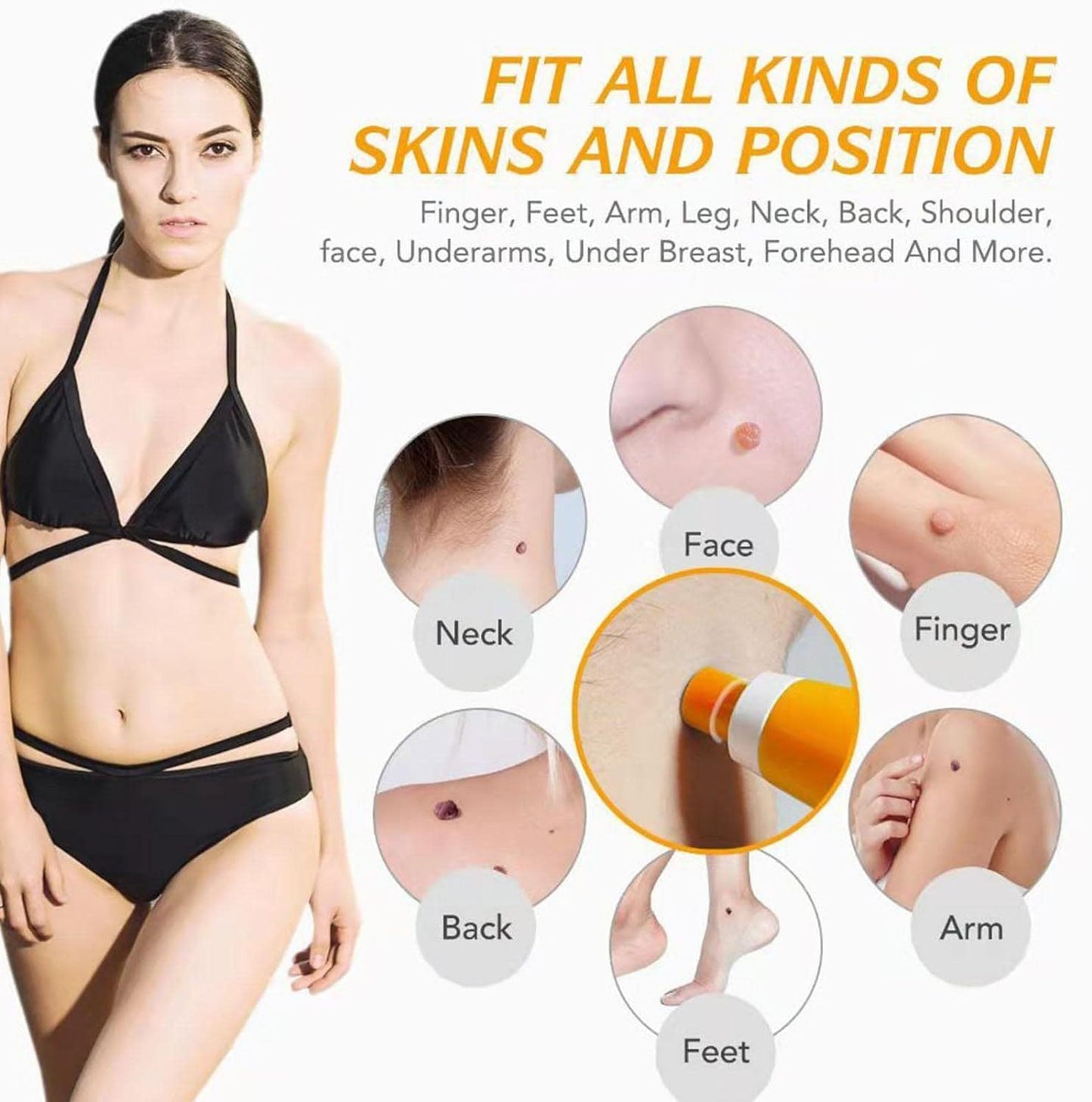 Skin-removing Pen Meat-removing Mole-removing Wart-removing Device 2-generation Boxed