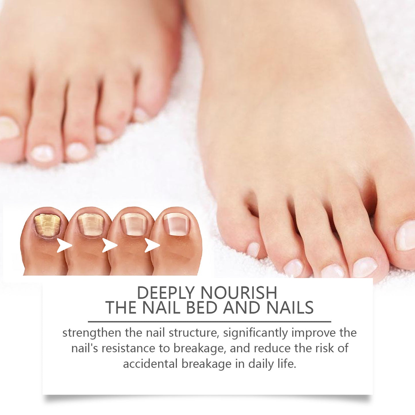 Bee Nail Repair Solution Brightening Nails