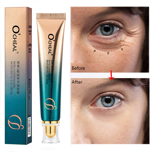 Moisturizing And Firming Eye Cream To Weaken Fine Lines And Dark Circles